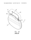 IMPLANTABLE PULSE GENERATOR FEEDTHRUS AND METHODS OF MANUFACTURE diagram and image