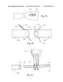 EMERGENCY VASCULAR REPAIR PROSTHESIS DEPLOYMENT SYSTEM diagram and image