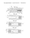 Method and Device for Treatment of Mitral Insufficiency diagram and image