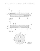 UVEOSCLERAL DRUG DELIVERY IMPLANT AND METHODS FOR IMPLANTING THE SAME diagram and image