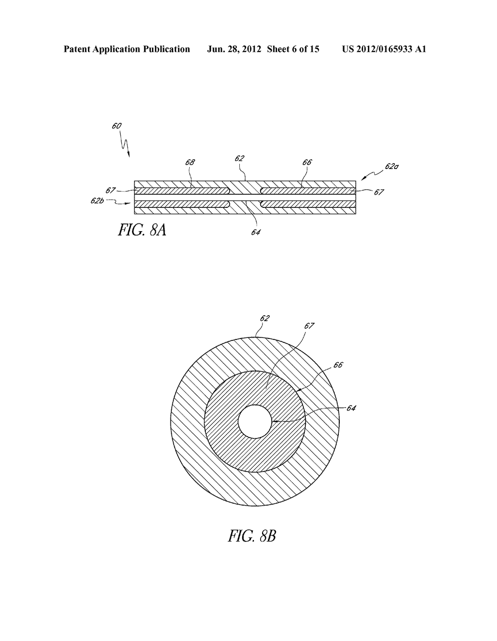 UVEOSCLERAL DRUG DELIVERY IMPLANT AND METHODS FOR IMPLANTING THE SAME - diagram, schematic, and image 07