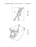 UVEOSCLERAL DRUG DELIVERY IMPLANT AND METHODS FOR IMPLANTING THE SAME diagram and image