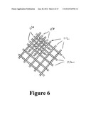 CEMENT-DIRECTING ORTHOPEDIC IMPLANTS diagram and image