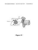 CEMENT-DIRECTING ORTHOPEDIC IMPLANTS diagram and image