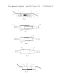 Universal laminoplasty implant diagram and image