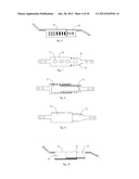 Universal laminoplasty implant diagram and image