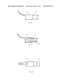 Universal laminoplasty implant diagram and image