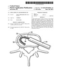 Spinal Implant And Method Of Use diagram and image