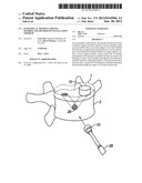 INTRADISCAL MOTION LIMITING MEMBER AND METHOD OF INSTALLATION THEREOF diagram and image