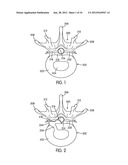 Disc Repair System diagram and image