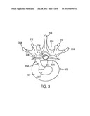 Disc Repair System diagram and image