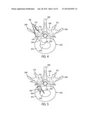 Disc Repair System diagram and image