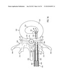 Disc Repair System diagram and image