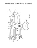 Disc Repair System diagram and image