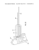 Disc Repair System diagram and image