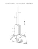 Disc Repair System diagram and image