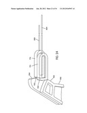 Disc Repair System diagram and image