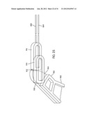 Disc Repair System diagram and image