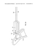 Disc Repair System diagram and image