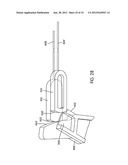 Disc Repair System diagram and image