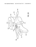 Disc Repair System diagram and image