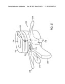 Disc Repair System diagram and image