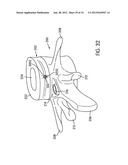 Disc Repair System diagram and image