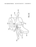 Disc Repair System diagram and image