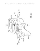 Disc Repair System diagram and image