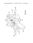 Disc Repair System diagram and image