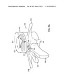 Disc Repair System diagram and image