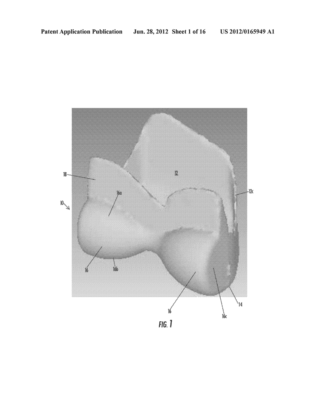 ORTHOPEDIC IMPLANT AND METHOD OF MAKING SAME - diagram, schematic, and image 02