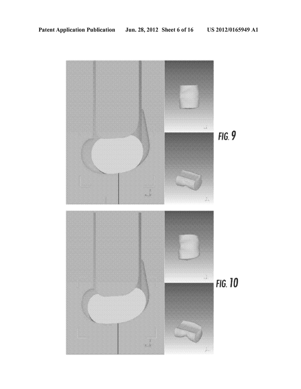 ORTHOPEDIC IMPLANT AND METHOD OF MAKING SAME - diagram, schematic, and image 07