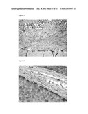 BIODEGRADABLE SCAFFOLD FOR SOFT TISSUE REGENERATION AND USE THEREOF diagram and image