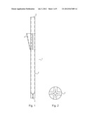 Anchor Post diagram and image