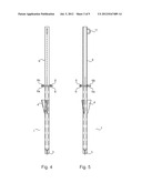 Anchor Post diagram and image