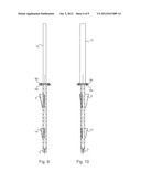 Anchor Post diagram and image