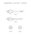 Anchor Post diagram and image