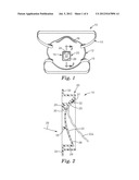 RESPIRATOR HAVING VALVE WITH AN ABLATED FLAP diagram and image