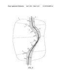 Window Covering with Cord Shrouds diagram and image