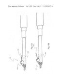 Apparatus for operating a zipper diagram and image