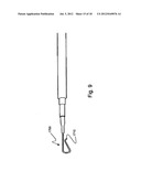 Apparatus for operating a zipper diagram and image