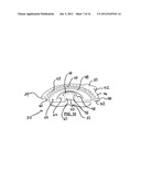 Continuously Engaged Recliner Freeplay System And Fine-Blanked Gear Hub diagram and image