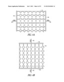 Electrode Crossovers diagram and image