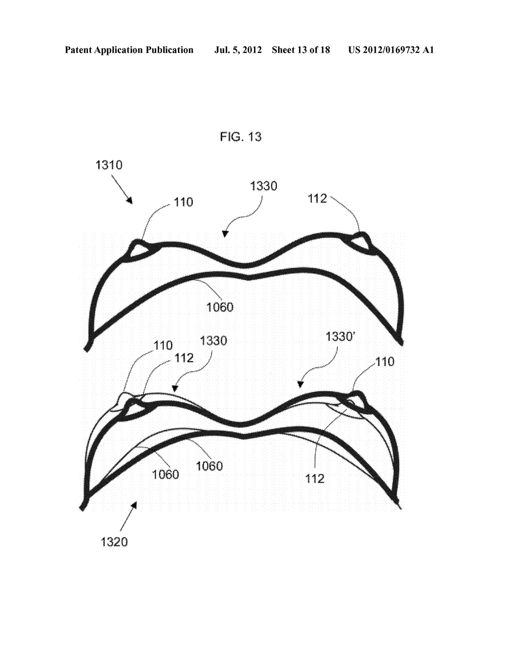 METHOD FOR ANALYSIS OF FACIAL APPEARANCE TO ASSIST MEDICAL PROCEDURE - diagram, schematic, and image 14