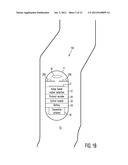 DETECTION OF WHEN A CAPSULE CAMERA ENTERS INTO OR GOES OUT OF A HUMAN BODY     AND ASSOCIATED OPERATIONS diagram and image