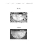 Apparatus for imaging a tissue region diagram and image