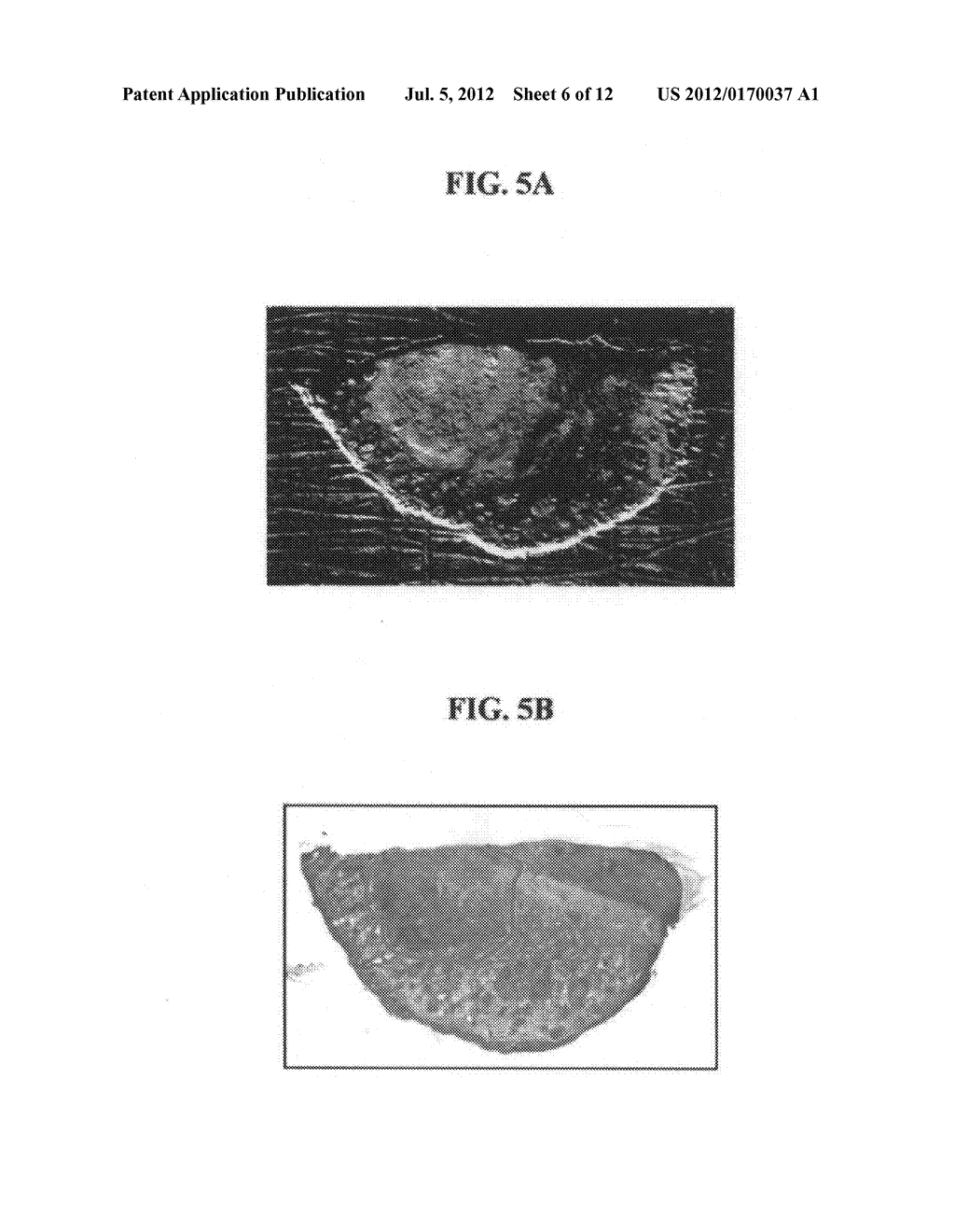 Apparatus for imaging a tissue region - diagram, schematic, and image 07