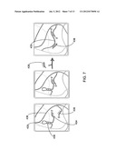 Reflective Diffractometric Hydrogel Sensor for Biological and Chemical     Detection diagram and image