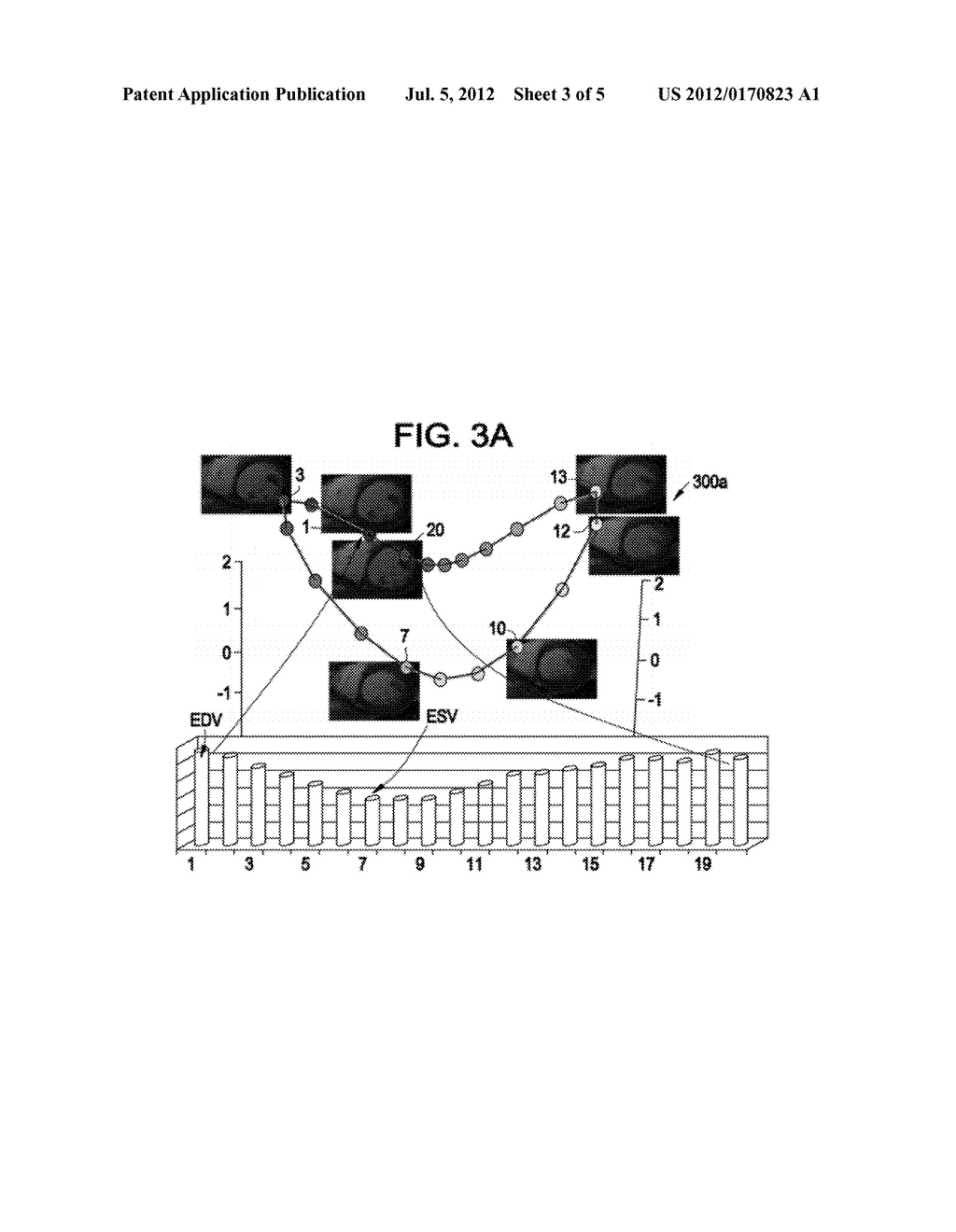 SYSTEM AND METHOD FOR IMAGE BASED MULTIPLE-MODALITY CARDIAC IMAGE     ALIGNMENT - diagram, schematic, and image 04